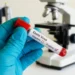 BMA Feature: Democratic Republic Of Congo Warns Of Highly Deadly Ebola Strain After Outbreak Declared