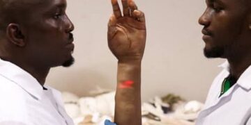 BMA Feature: Nigerian Brothers Pioneer Hyperrealistic Bionic Arm Tailored For Darker Skin Tones