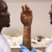 BMA Feature: Nigerian Brothers Pioneer Hyperrealistic Bionic Arm Tailored For Darker Skin Tones